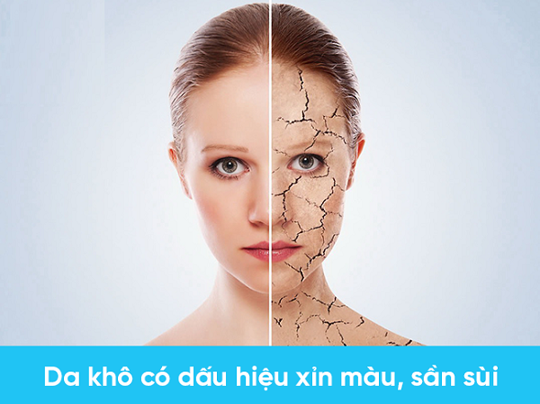 Da khô thường có dấu hiệu xỉn màu, bong tróc