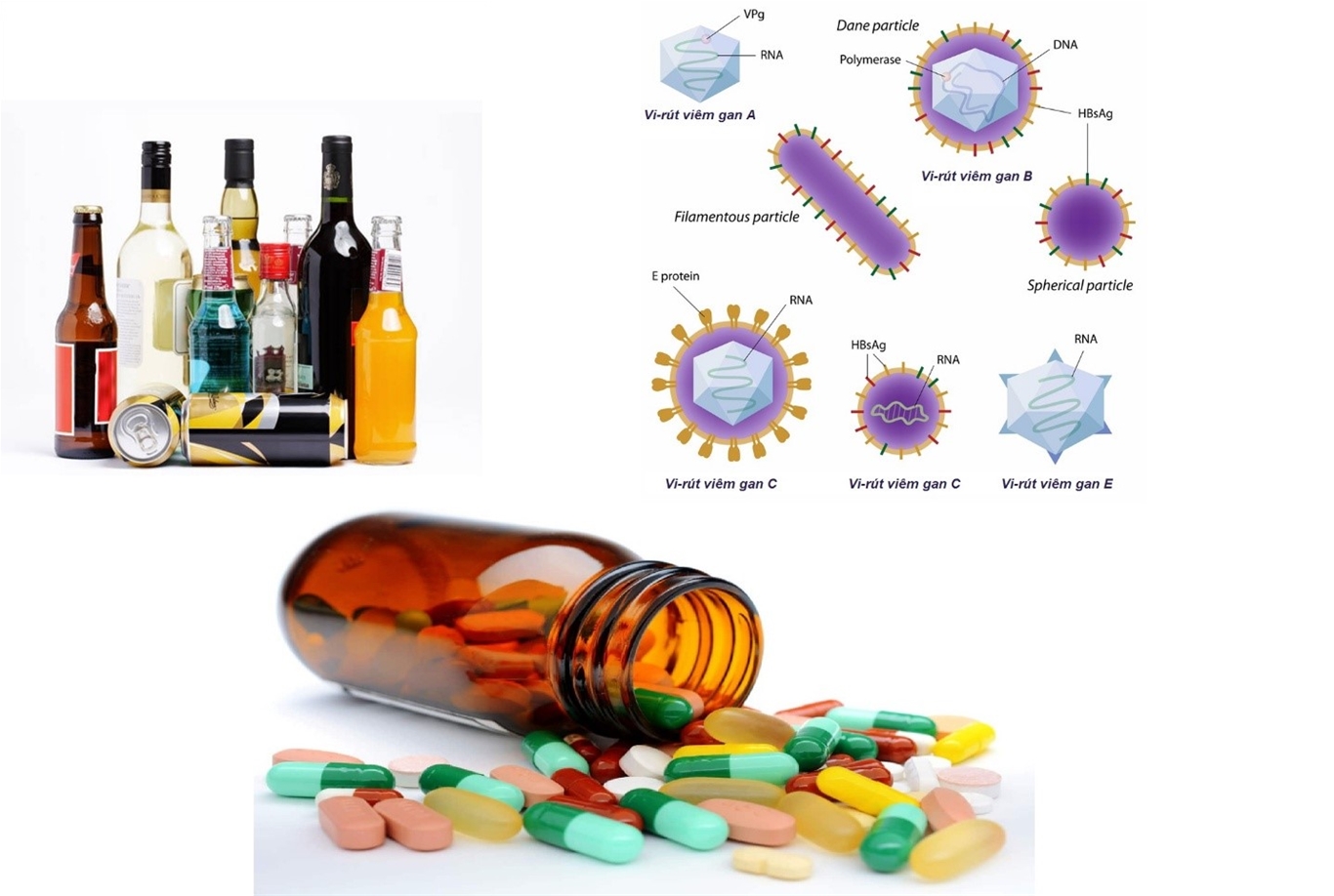 3 nguyên nhân gây xơ gan phổ biến tại Việt Nam
