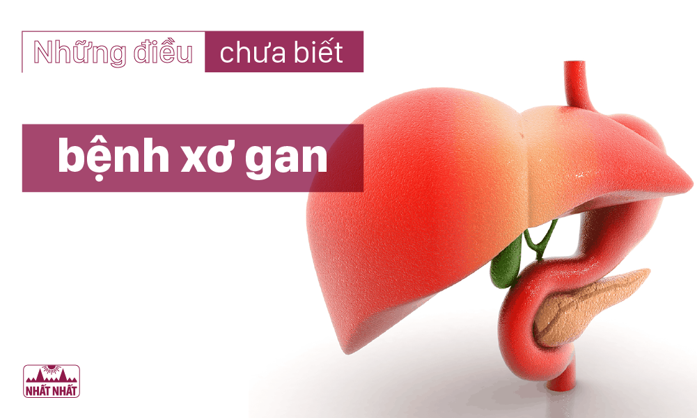 bệnh xơ gan