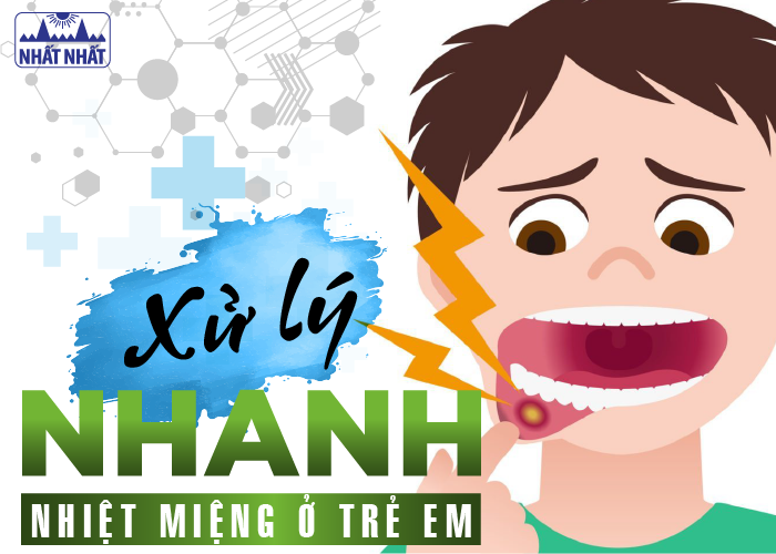 xử lý nhanh nhiệt miệng ở trẻ