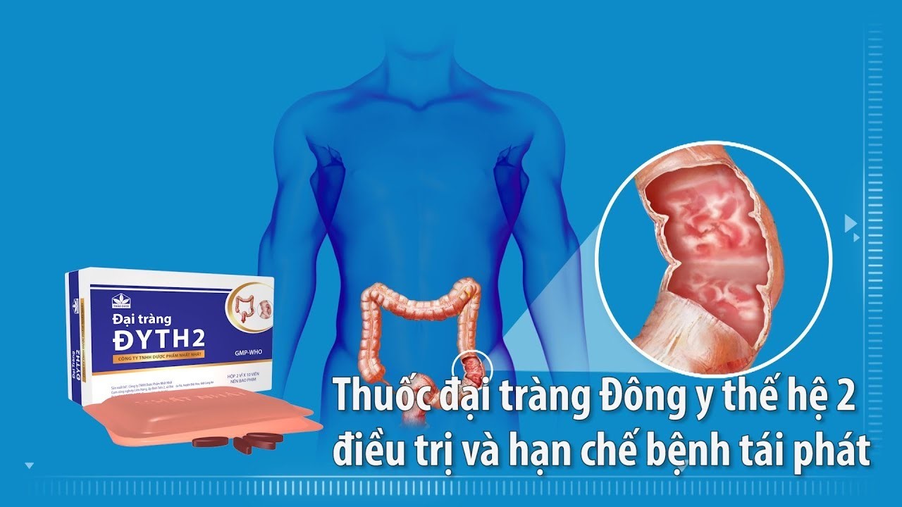 Thuốc đại tràng Đông y thế hệ 2 hạn chế bệnh tái phát