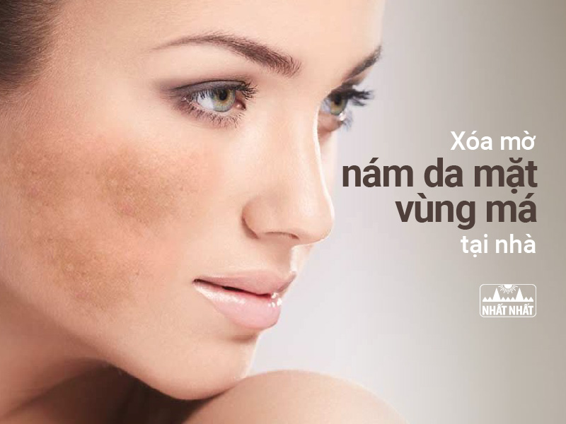 nám da vùng má