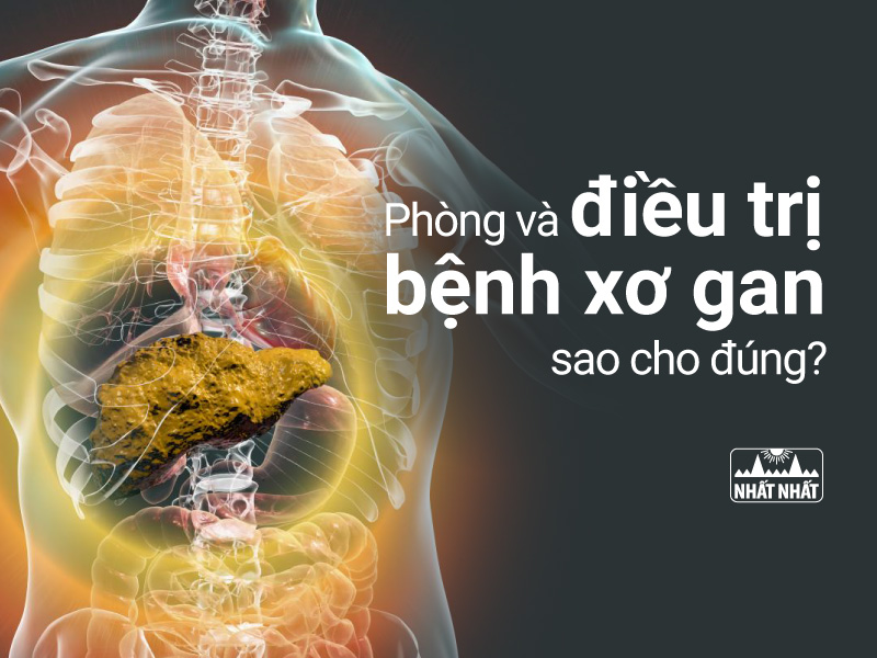 bệnh xơ gan