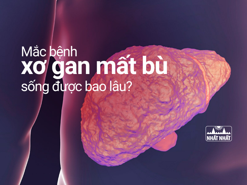 xơ gan mất bù