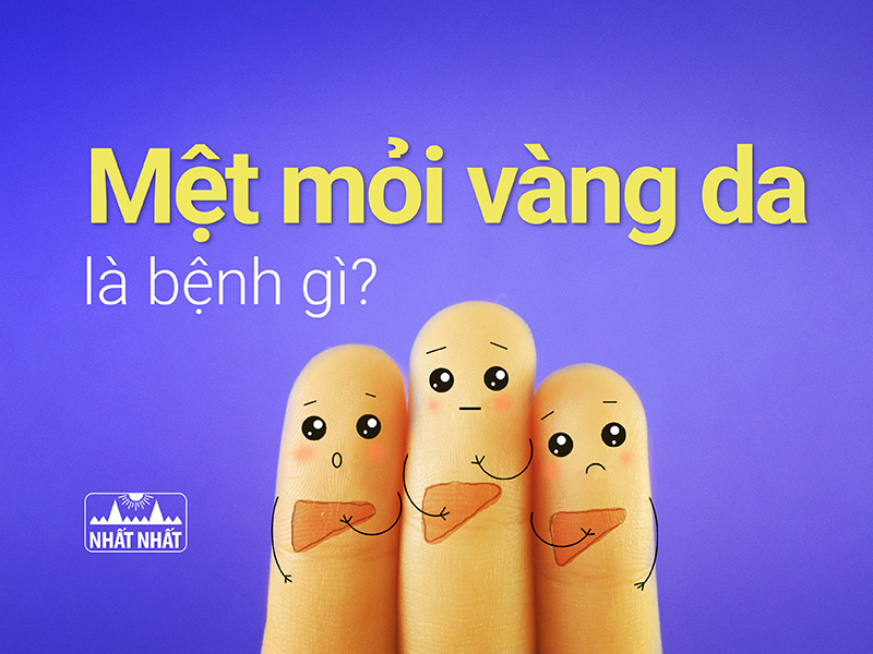 mệt mỏi vàng da là bệnh gì