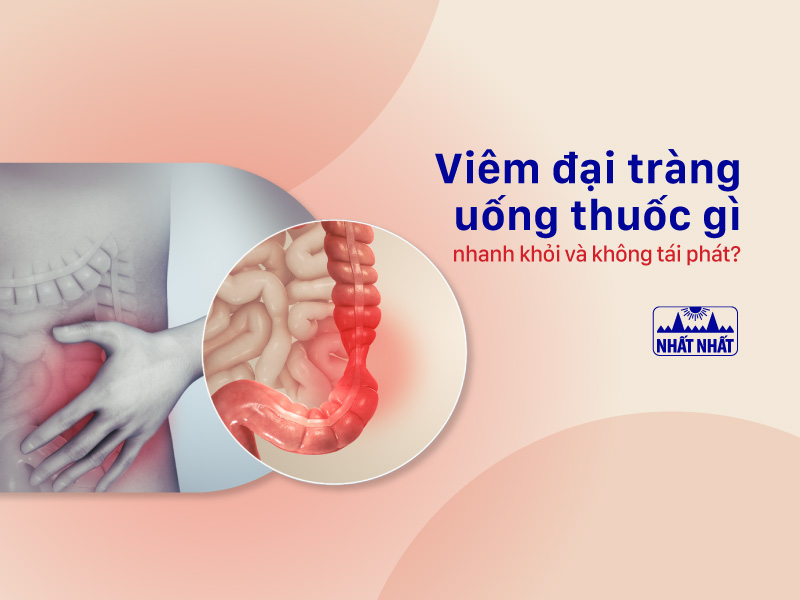 Viêm đại tràng uống thuốc gì