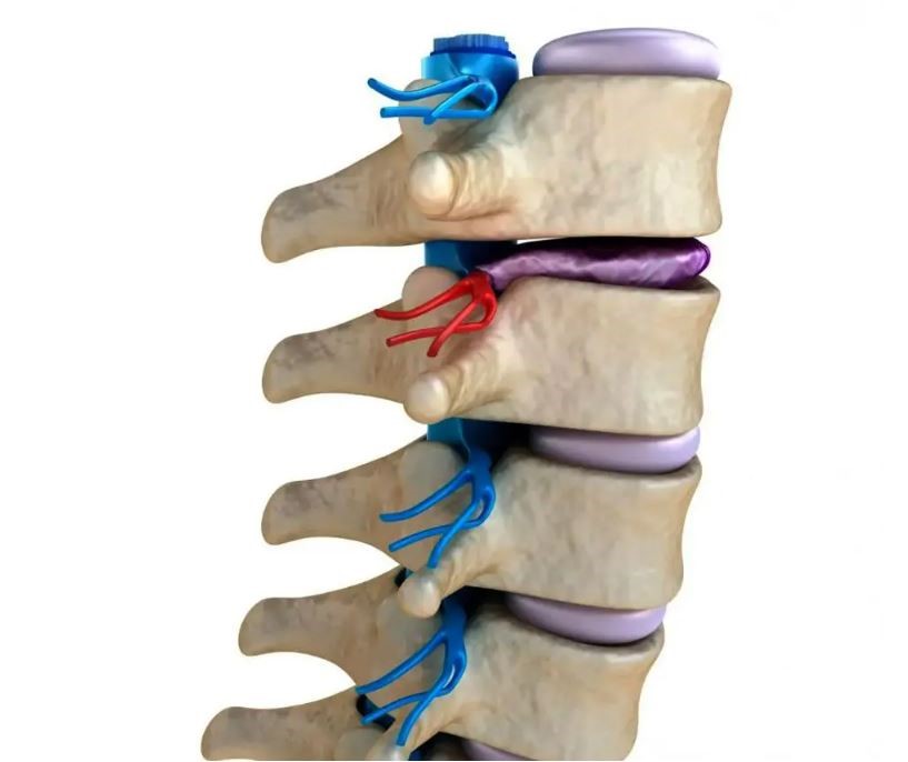 Khô đĩa đệm có thể đẩy nhanh tốc độ thoái hóa đốt sống cổ