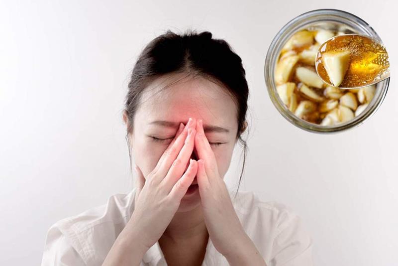 Tìm cách trị viêm xoang tại nhà hiệu quả là việc cần thiết