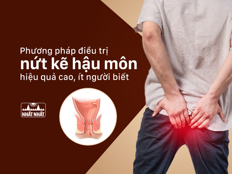 điều trị nứt kẽ hậu môn