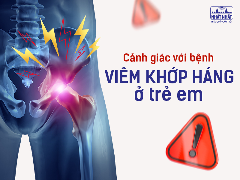 Viêm khớp háng ở trẻ em là một bệnh lý xương khớp phổ biến