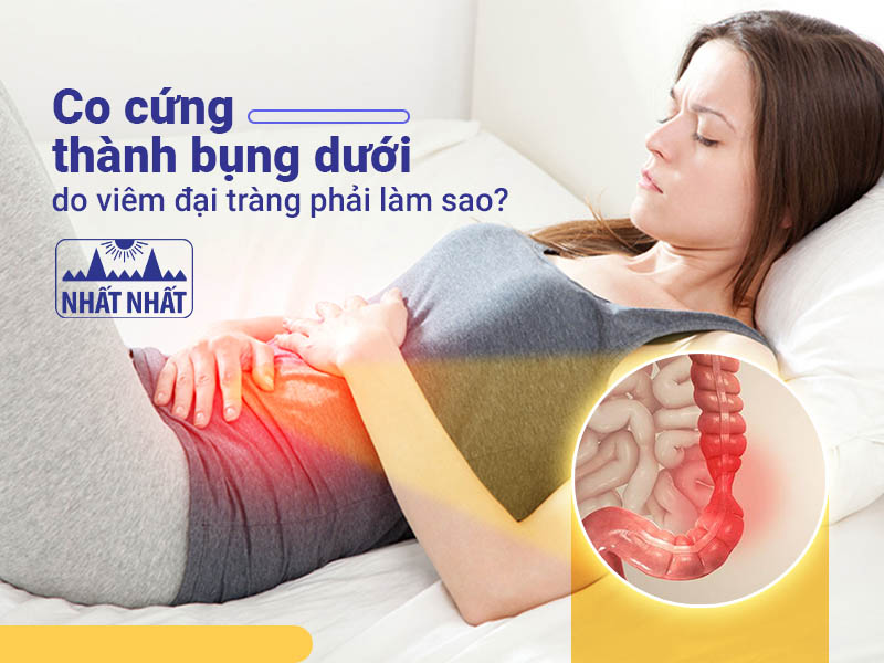 Co cứng thành bụng