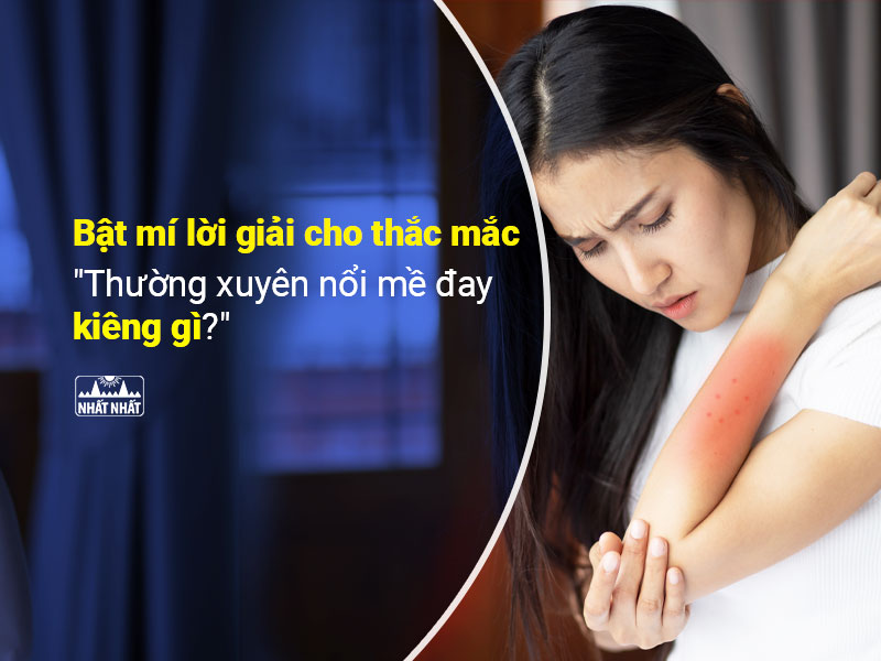Nổi mề đay kiêng gì 
