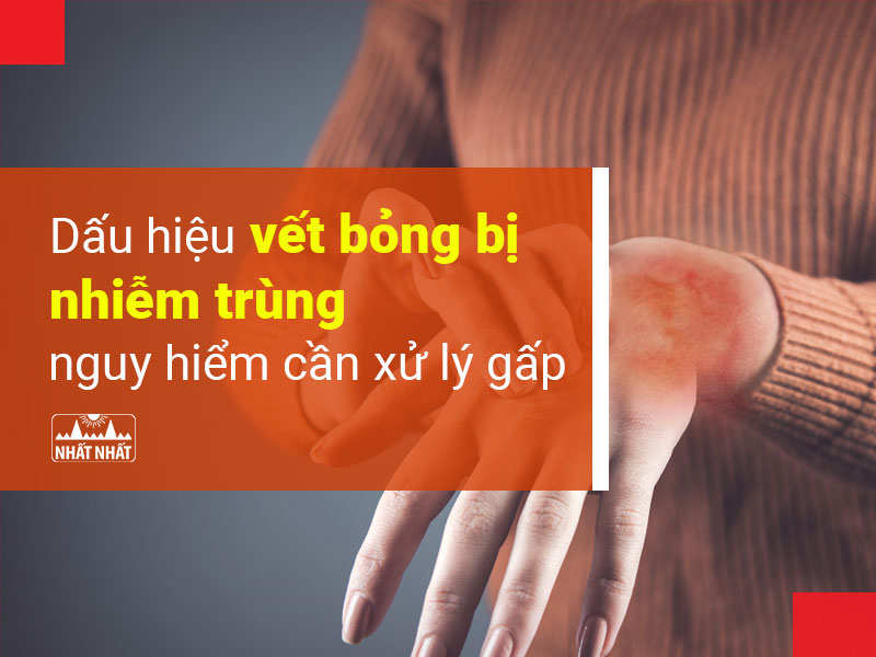 dấu hiệu vết bỏng bị nhiễm trùng