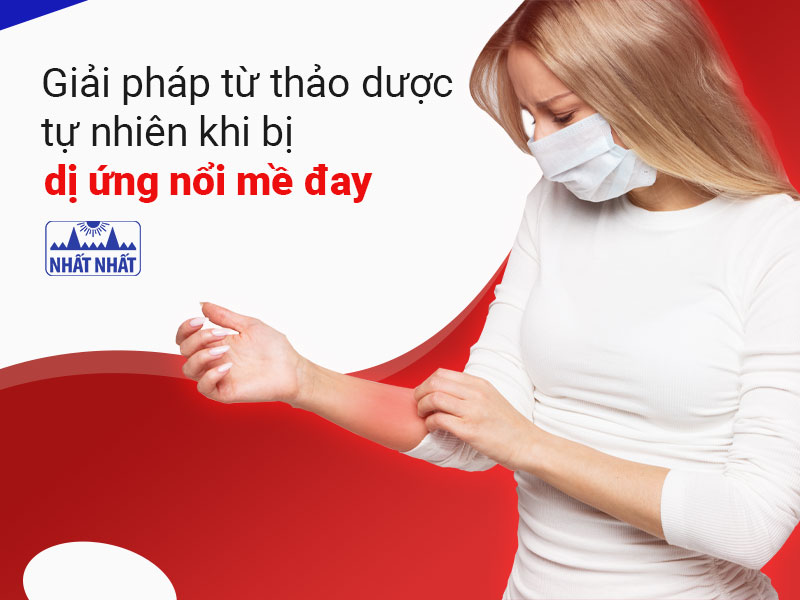 Dị ứng nổi mề đay 