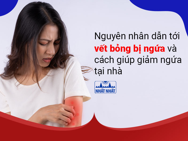vết bỏng bị ngứa          