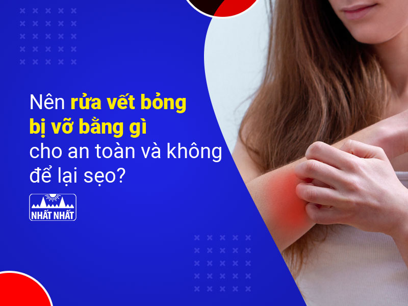 rửa vết bỏng bị vỡ bằng gì