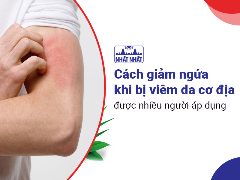 cách giảm ngứa khi bị viêm da cơ địa