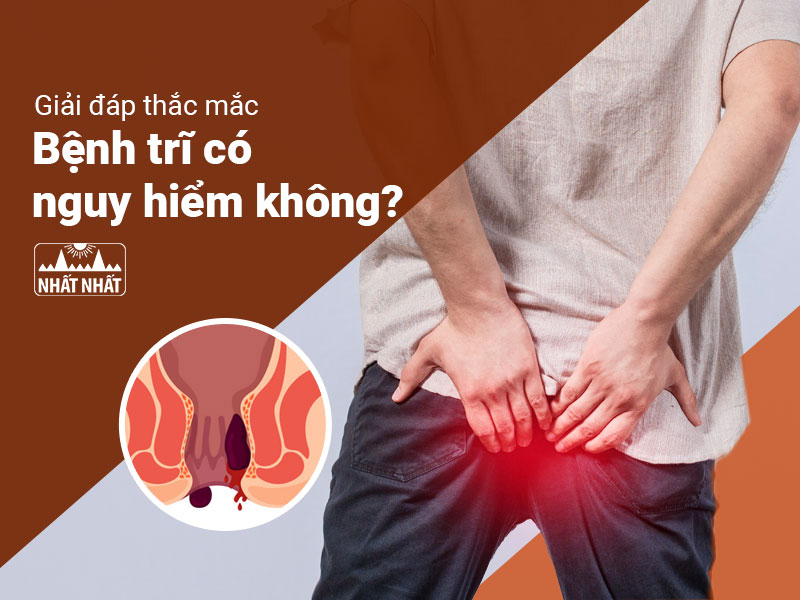 bệnh trĩ có nguy hiểm không