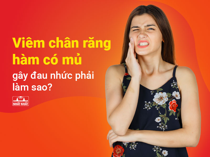 Viêm chân răng hàm có mủ 