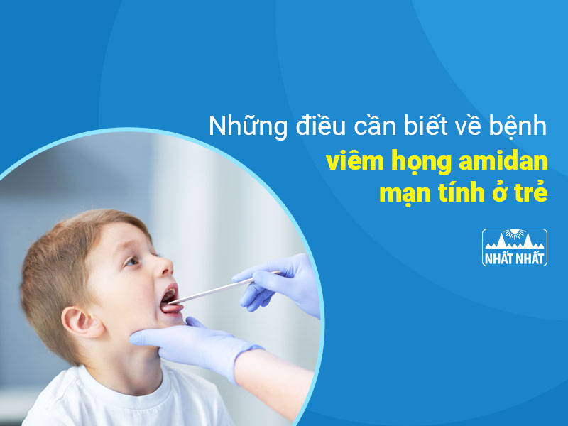 Viêm họng amidan mạn tính