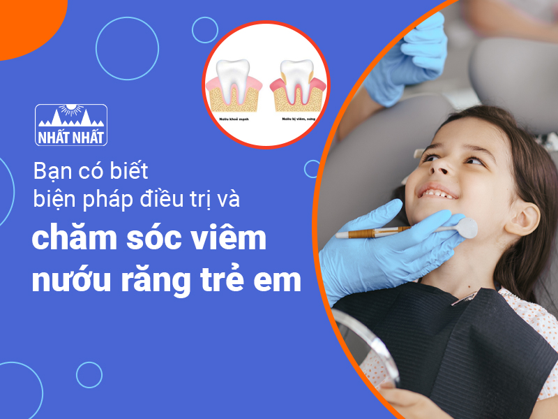 Viêm nướu răng trẻ em