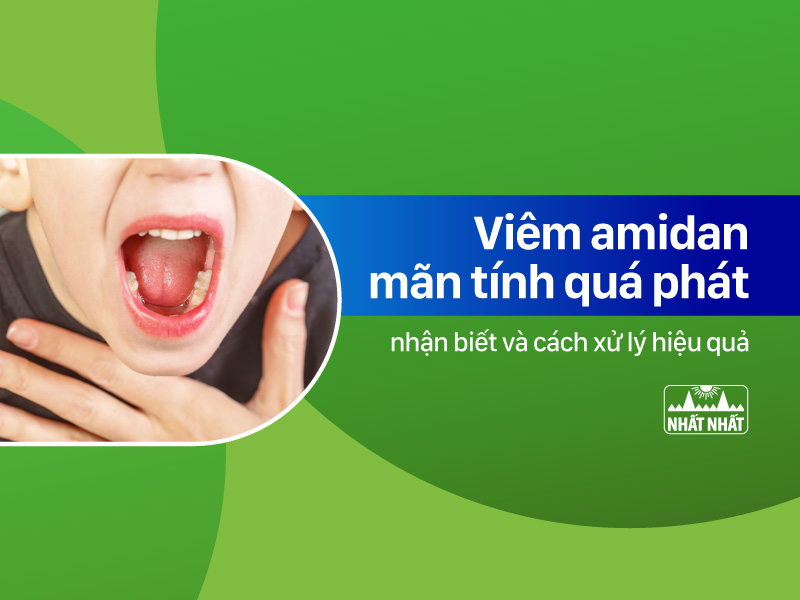 Viêm amidan quá phát 