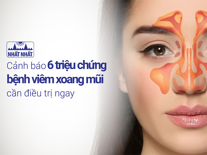 triệu chứng bệnh viêm xoang mũi