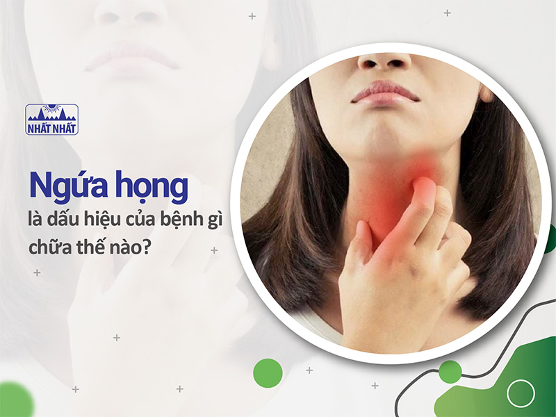 ngứa họng là dấu hiệu của bệnh gì