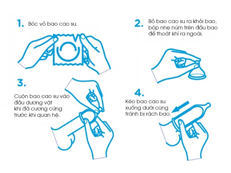 bao cao su là cái gì