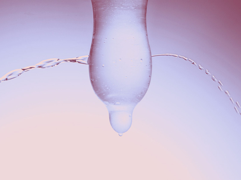 Bao cao su bị rách 