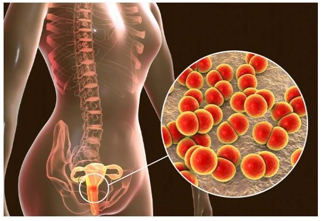 bệnh phụ khoa thường gặp