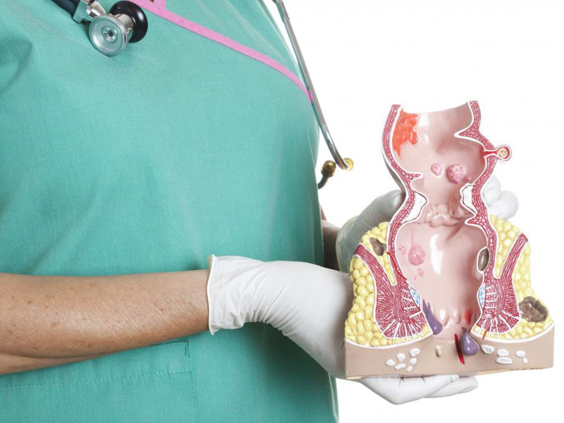 Bệnh trĩ có chữa được không