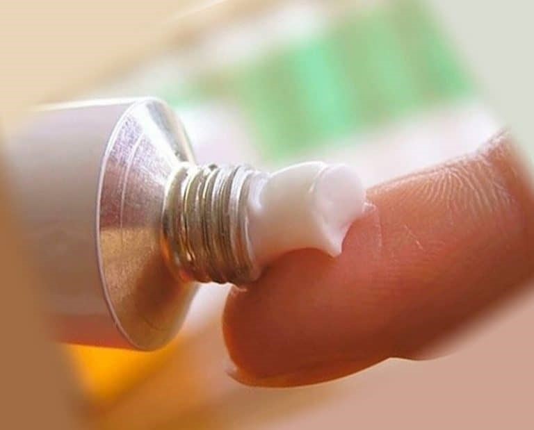 bệnh trĩ uống thuốc gì