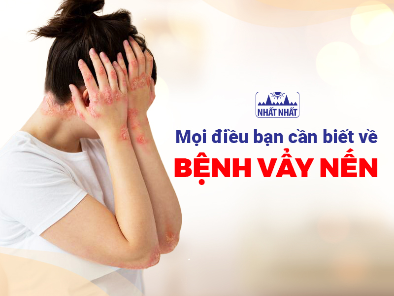 Bệnh vẩy nến gây khó chịu, giảm tự tin khi giao tiếp
