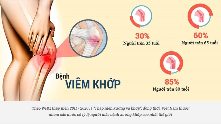 bệnh viêm khớp là gì