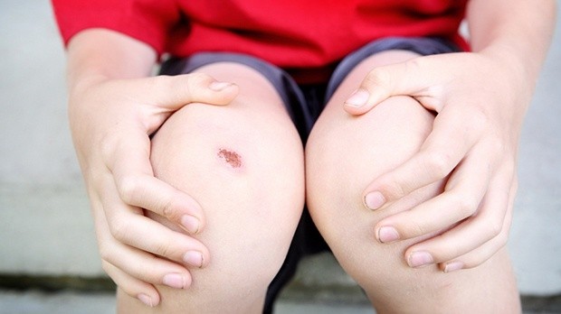 bổ sung kẽm cho cơ thể