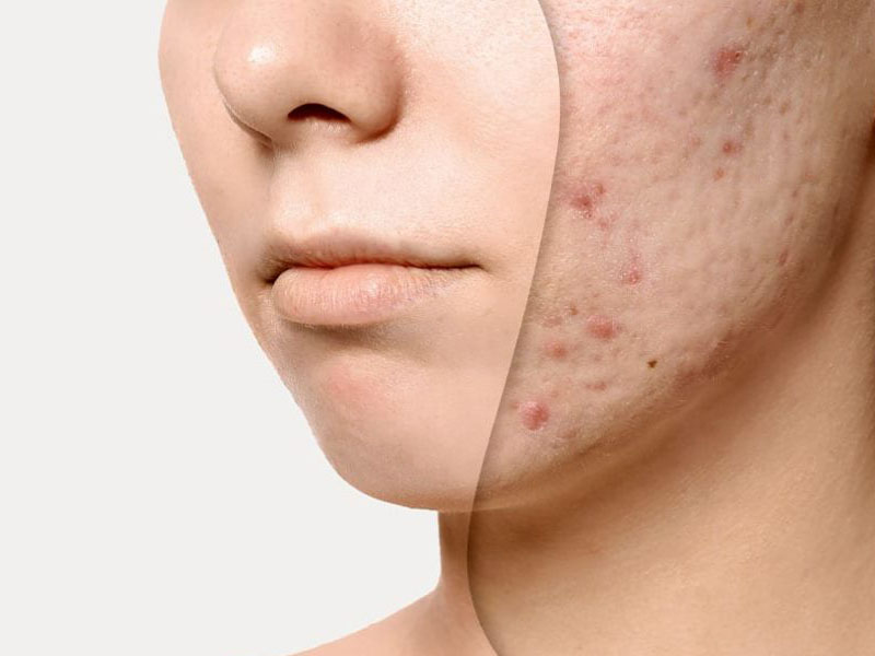 bổ sung kẽm có tác dụng gì