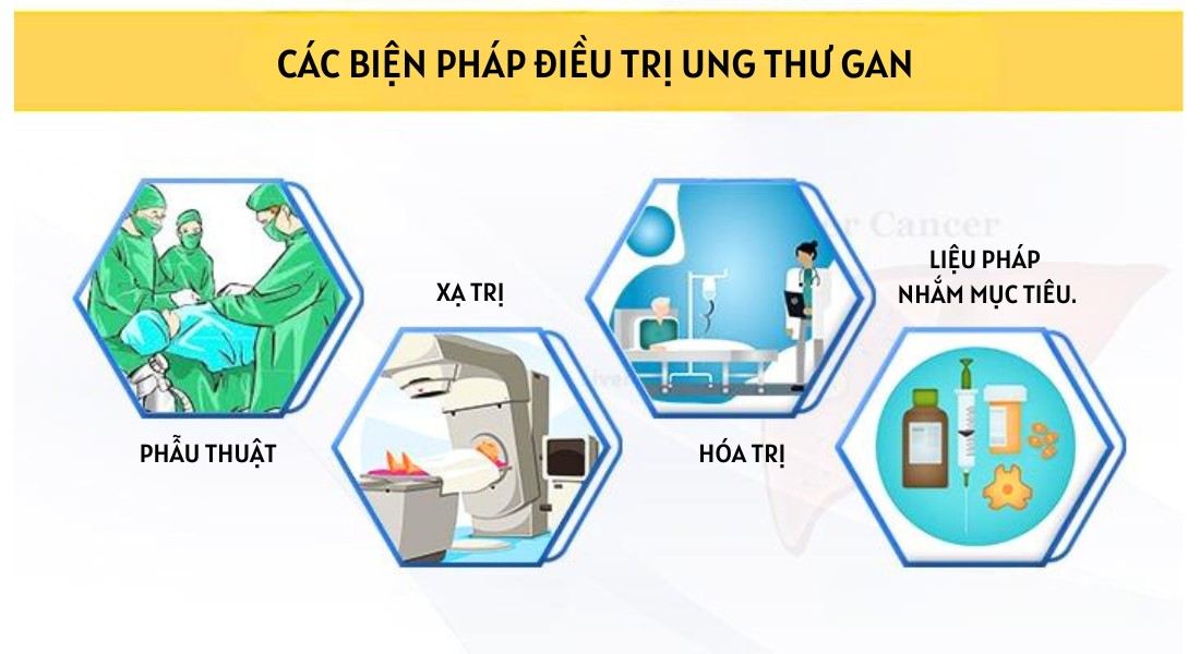 Các biện pháp điều trị ung thư gan