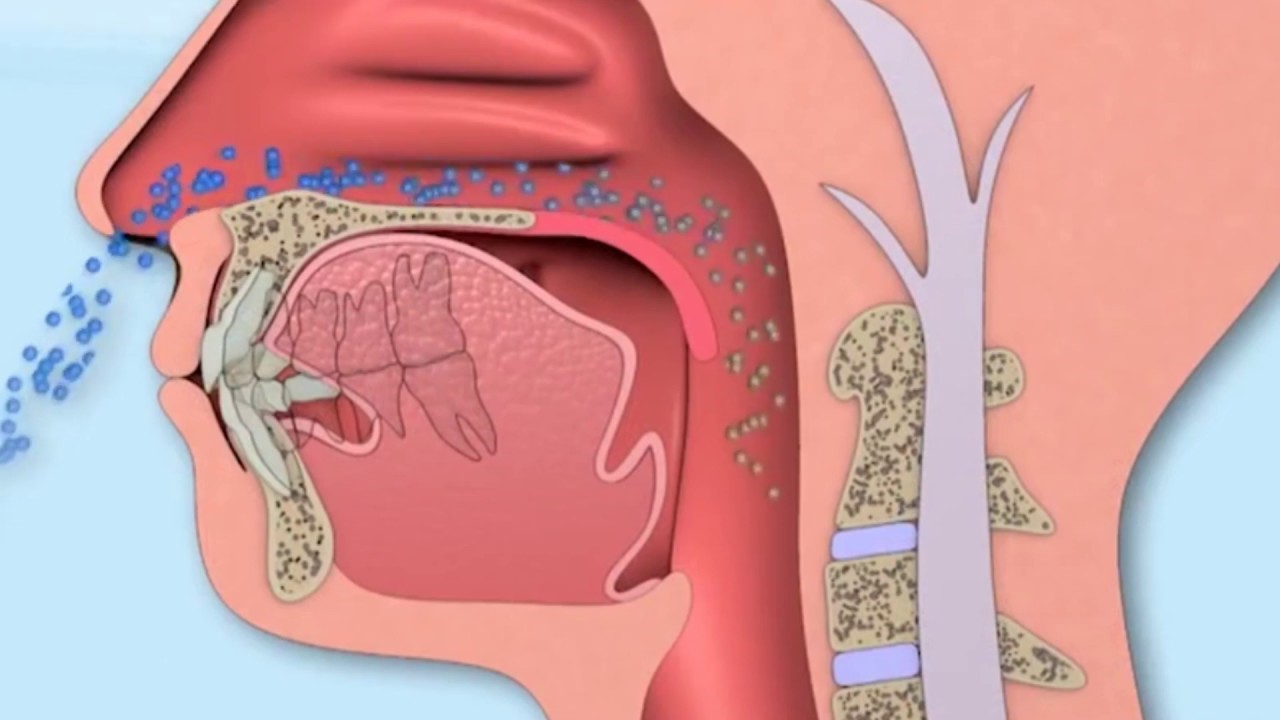 Cách thông mũi khi bị nghẹt