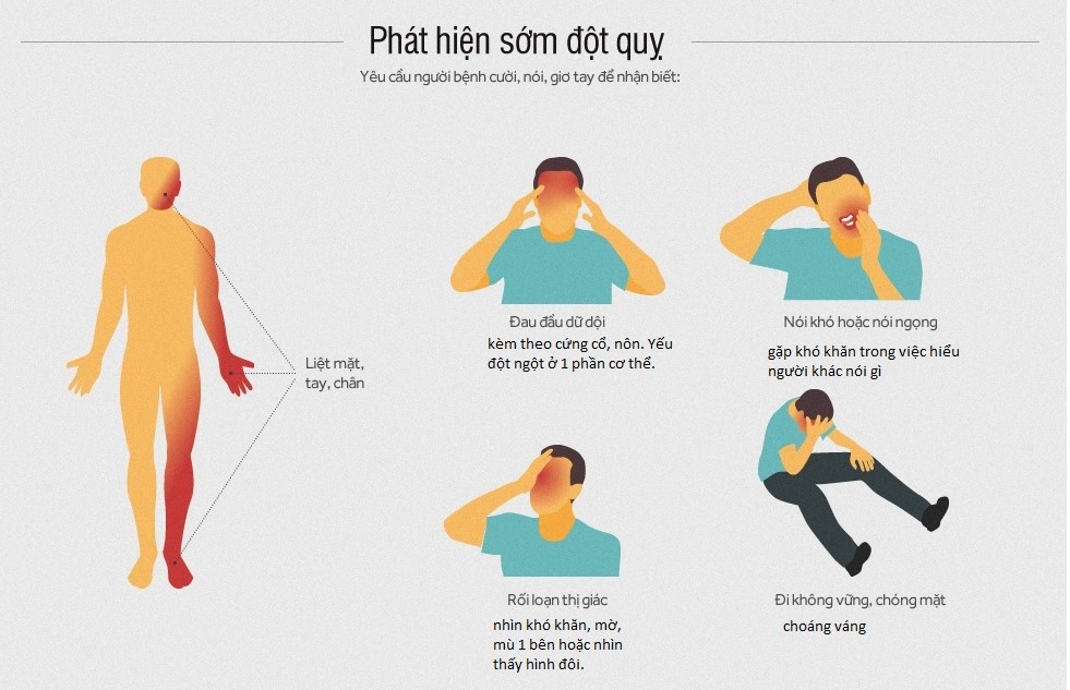 dấu hiệu bị tai biến