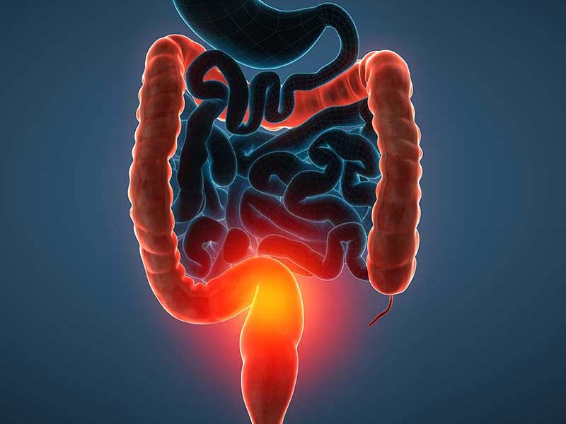 Co cứng thành bụng