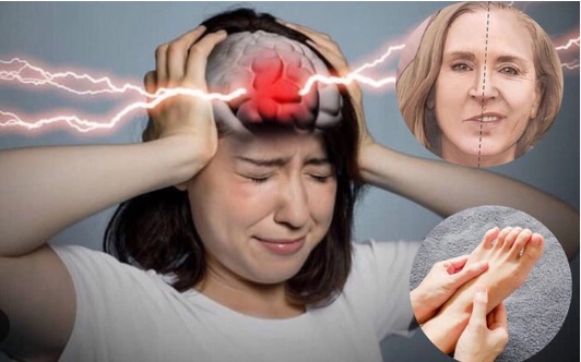 cơn thiếu máu não thoáng qua