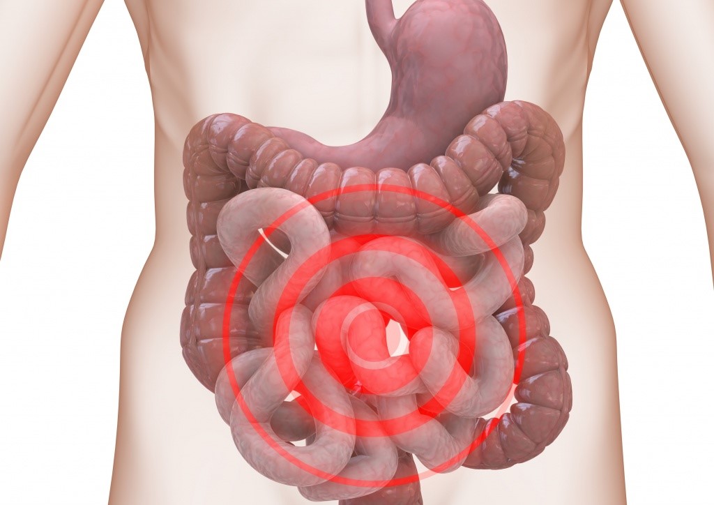 có cục cứng ở bụng bên phải