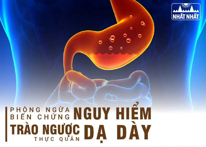 trào ngược dạ dày thực quản