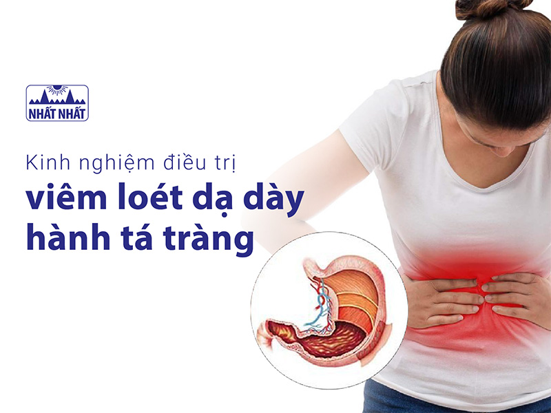 Viêm loét dạ dày hành tá tràng