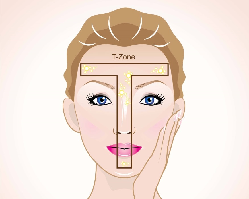 Da dầu thường đổ nhiều dầu ở vùng chữ T