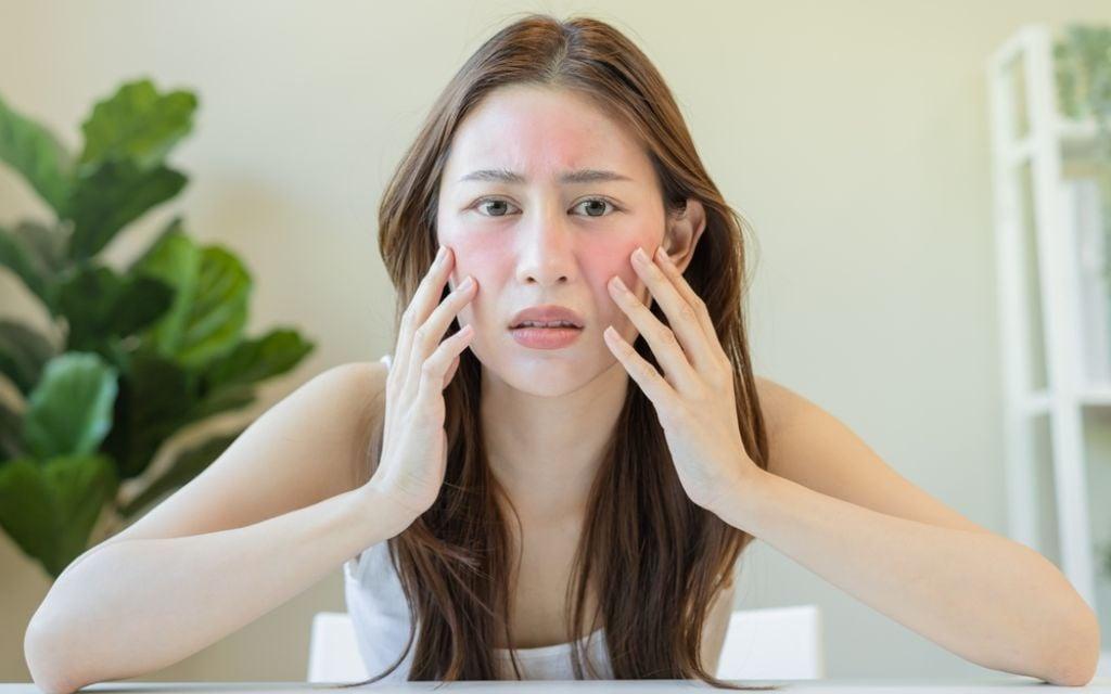 Da khô dễ bị kích ứng khi tiếp xúc với các yếu tố gây hại