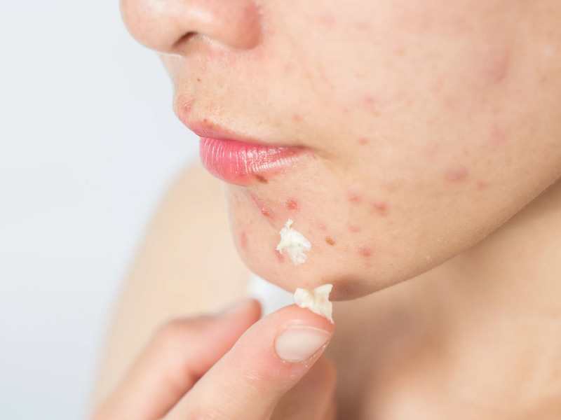 da sạm màu phải làm sao