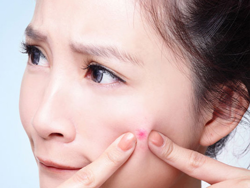 sữa rửa mặt dành cho tuổi dậy thì