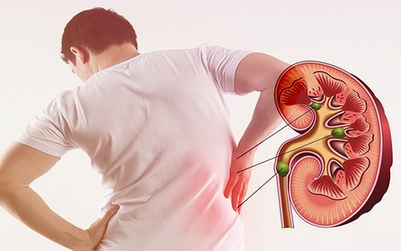 đau bụng dưới ở nam